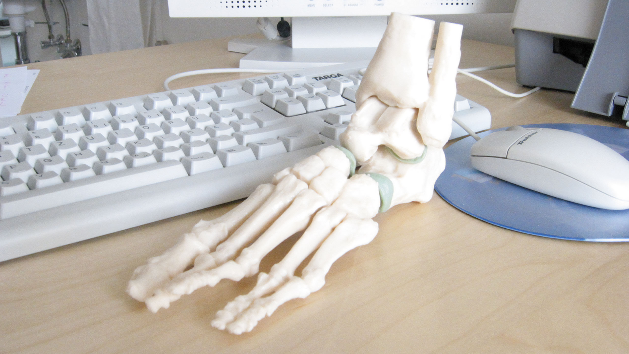 Begleitung bei Osteoporose